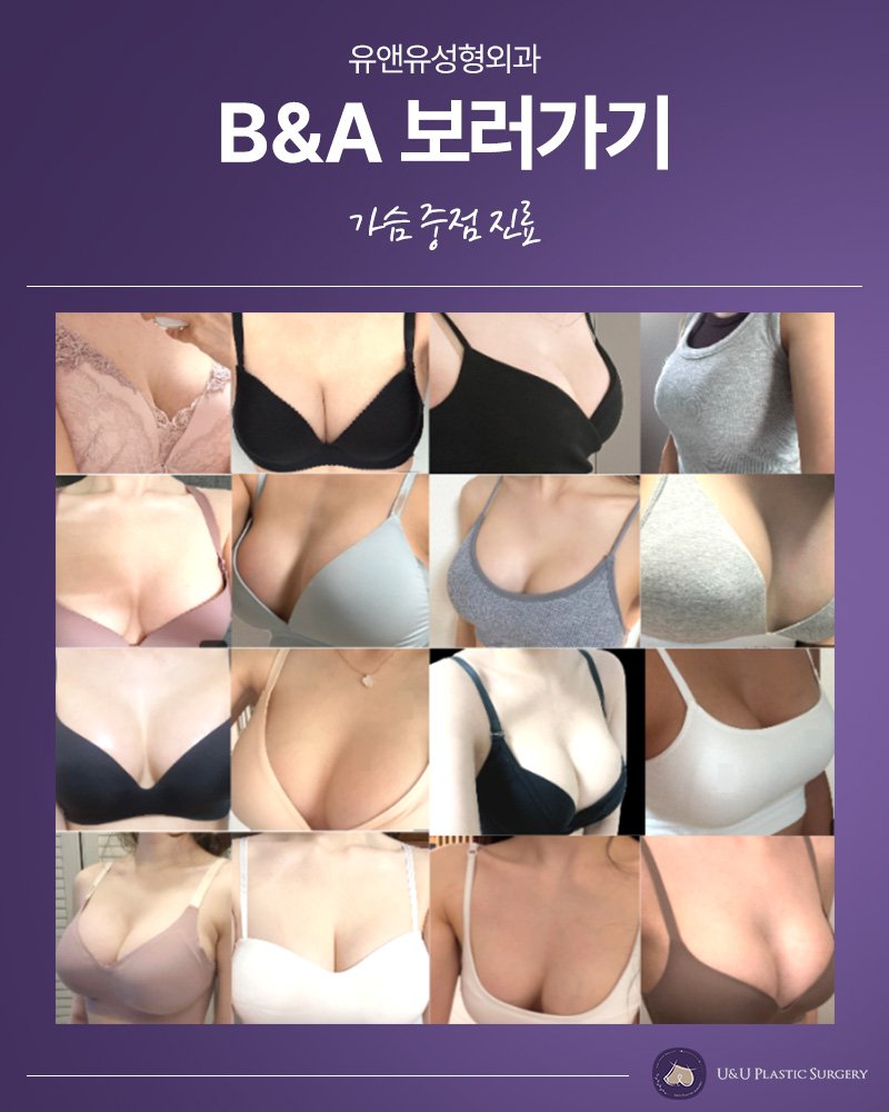 강남 가슴성형 회복
